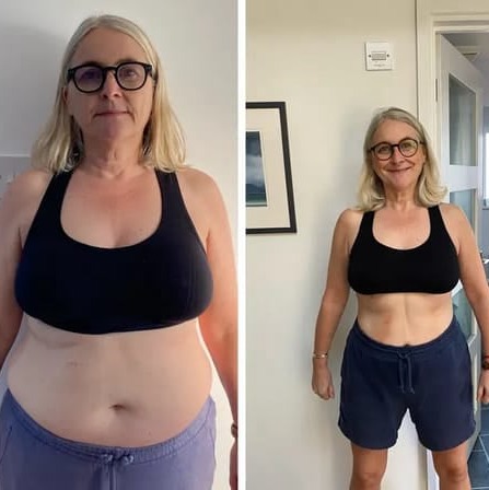 OzemPatch Customer ~Lisa P.